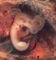 embrion prima luna sarcina